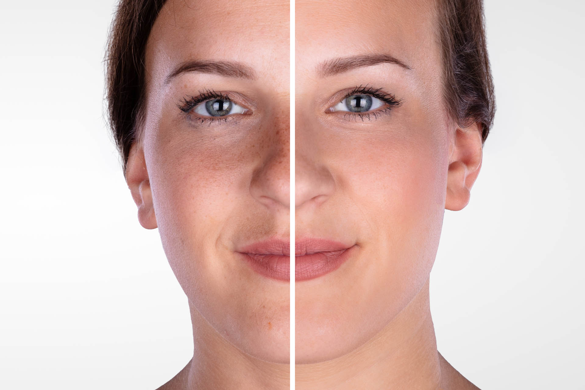 Before and After of Botox and Filler Certification Classes